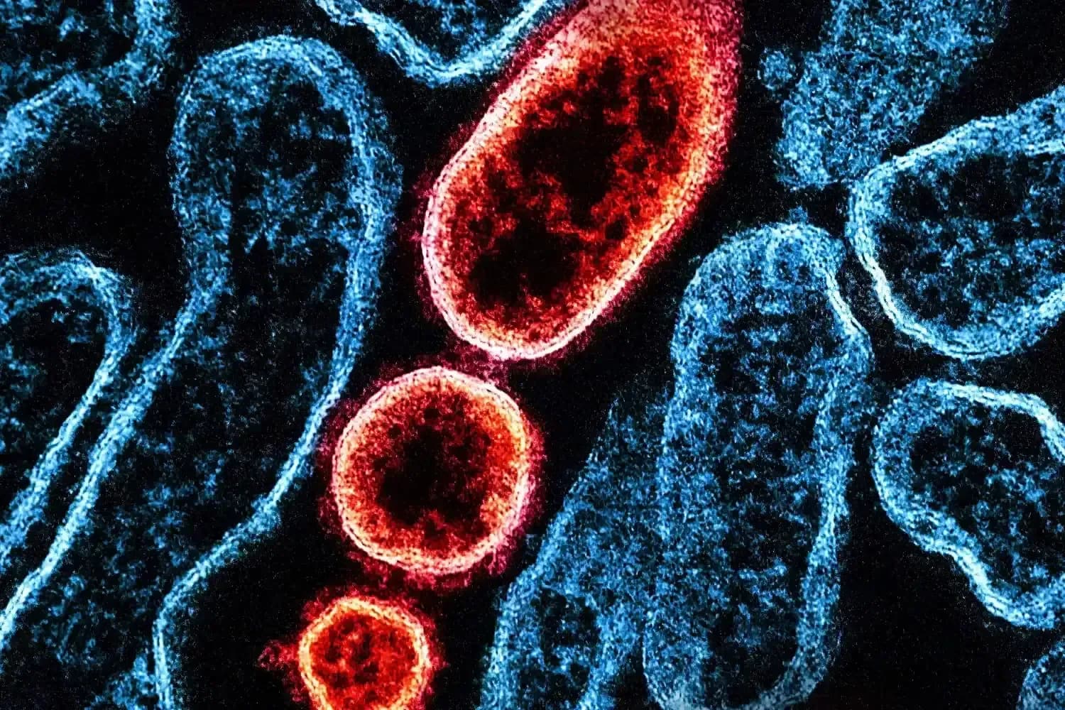 Nipah Virus Traveller Update | BudgetBro